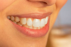 Teeth whitening - is it safe?